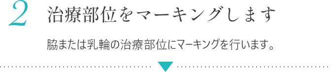 2 治療部位をマーキングします