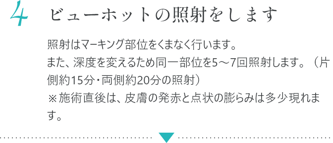 4 ビューホットの照射をします